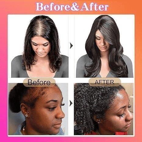 100% Batana Oil Conditioner 120ml - Gtworld.de