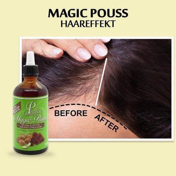 Profix Magic Pouss Natural Elixir for Hair - Root - Stimulation 100ml - Gtworld.de