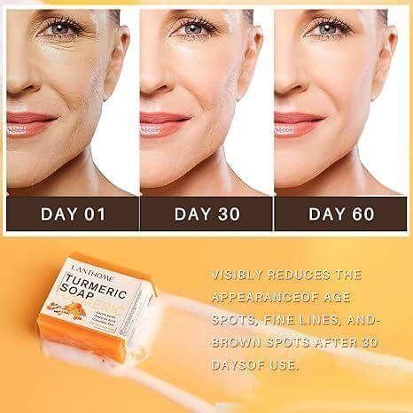 Turmeric Soap Bar For Face & Body 3.53oz/100g - Gtworld.de