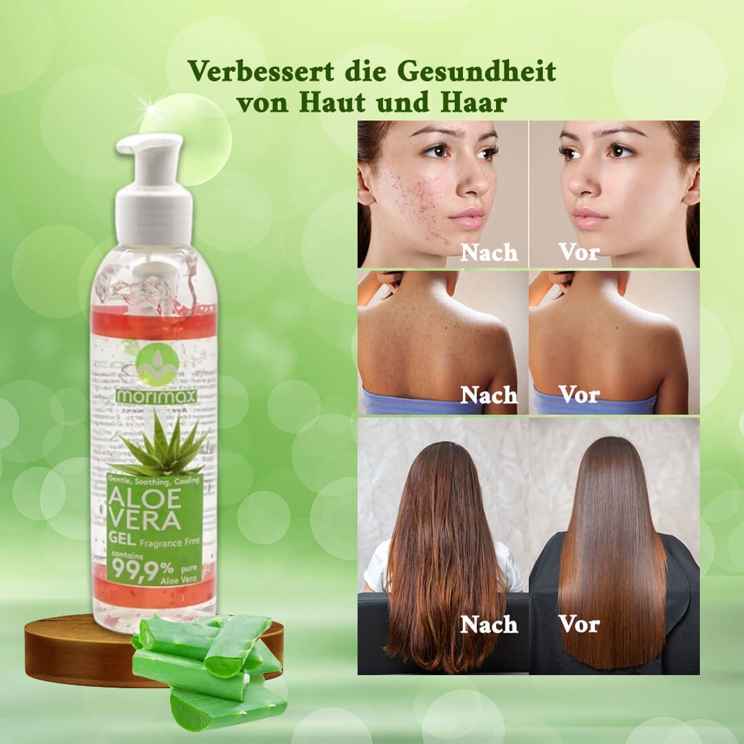 Aloe-Vera-Gel-DE2