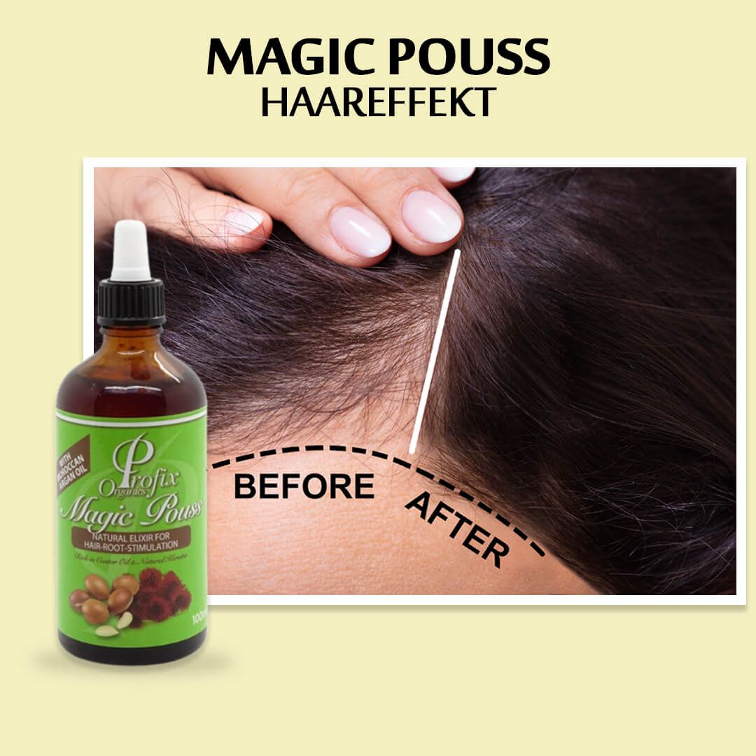 Profix-Magic-Pouss-Natural-Elixir-for-Hair-Root-Stimulation-100ml-DE