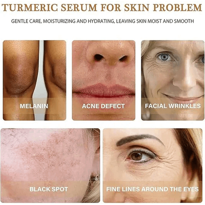 Turmeric Oil Serum 100% Pure &amp; Natural 30ml